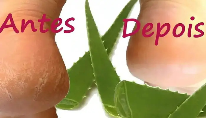 Como tirar rachaduras dos pés
