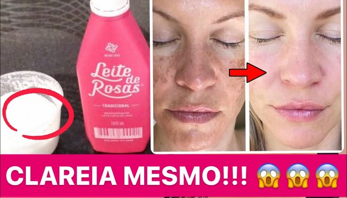 COMO REMOVER MANCHAS NA PELE