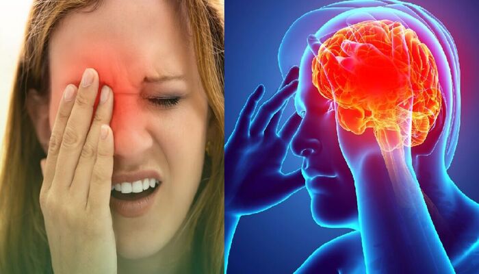 11 Sintomas que Indicam que Você Pode Ter um Aneurisma Cerebral