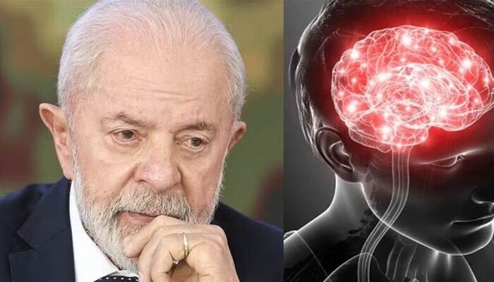 hemorragia intracraniana