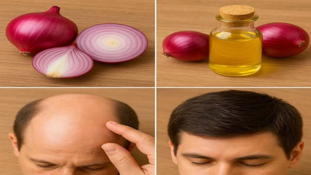 Cebola Roxa para o Crescimento Capilar